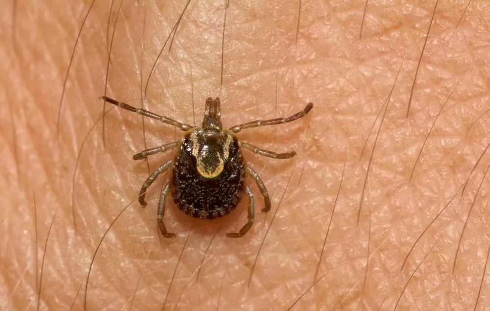 Matozinhos confirma novo caso de febre maculosa e soma três registros em 2025