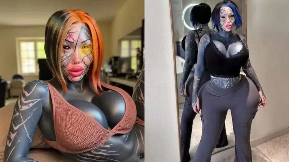 Modelo que gastou R$ 2,6 milhões em modificações corporais divulga foto de antes das cirurgias