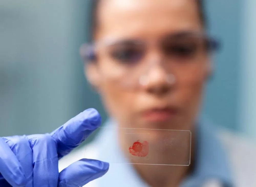 SUS passa a usar antibiótico para prevenir sífilis e clamídia após exposição ao risco