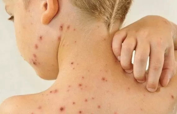 Divulgação: Internet 