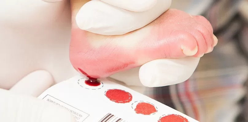 Minas Gerais passa a oferecer Teste do Pezinho ampliado com rastreamento de 64 doenças