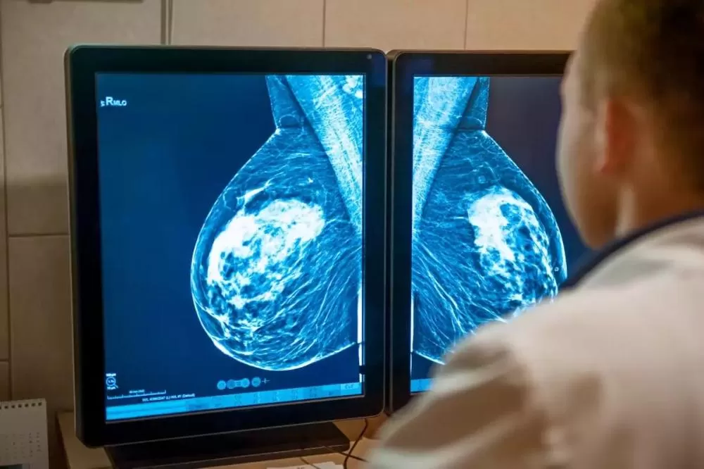 Betim tem mais de mil mulheres na fila para mamografia