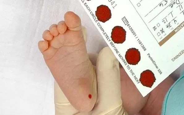 Teste do pezinho ampliado pelo SUS ajuda no diagnóstico precoce de 64 doenças em Contagem