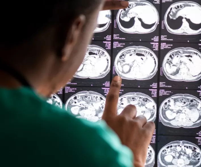 Hospital Lindouro Avelar consolida referência no tratamento de AVC e projeta ampliação dos serviços