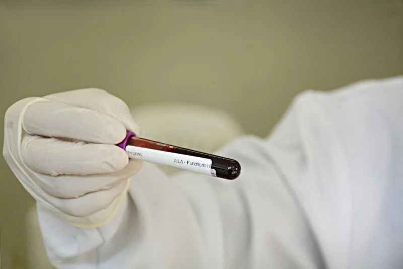 Exame de sangue que busca sinais de mais de 50 tipos de câncer chega ao Brasil