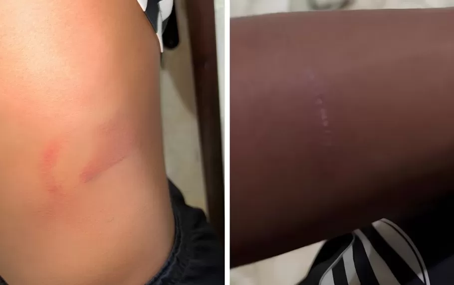 Pais de atletas denunciam agressões em alojamento do Athletic Club em São João del-Rei