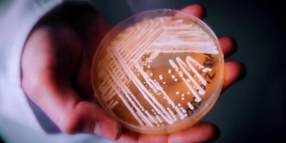 Sobe para quatro o número de casos de superfungo resistente a medicamentos em Belo Horizonte