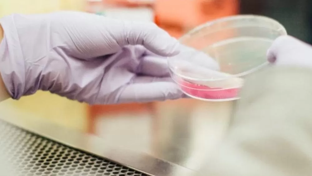 Paciente infectado por superfungo morre em BH; óbito não tem relação com a infecção, dizem autoridades