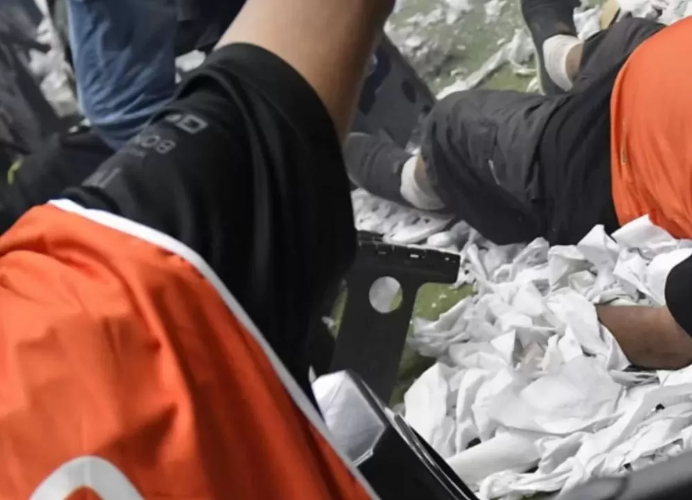 Fotógrafo é atingido por bomba na Arena MRV e precisa de cirurgia após fraturas