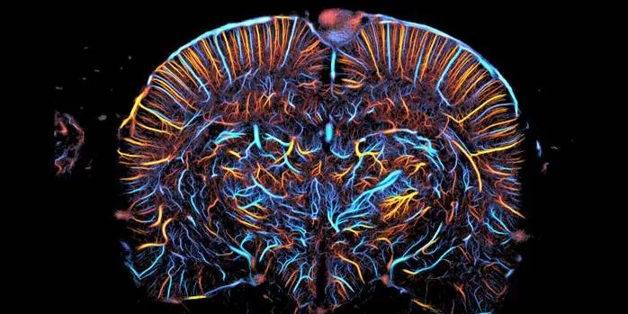 UFMG recebe ultrassom cerebral de alta precisão para avançar em pesquisas sobre Parkinson