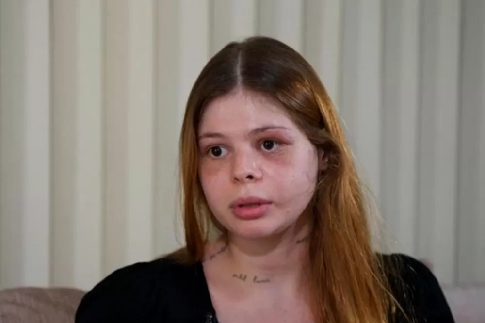 Mulher agredida com mais de 50 socos fala pela primeira vez sobre ataque do namorado