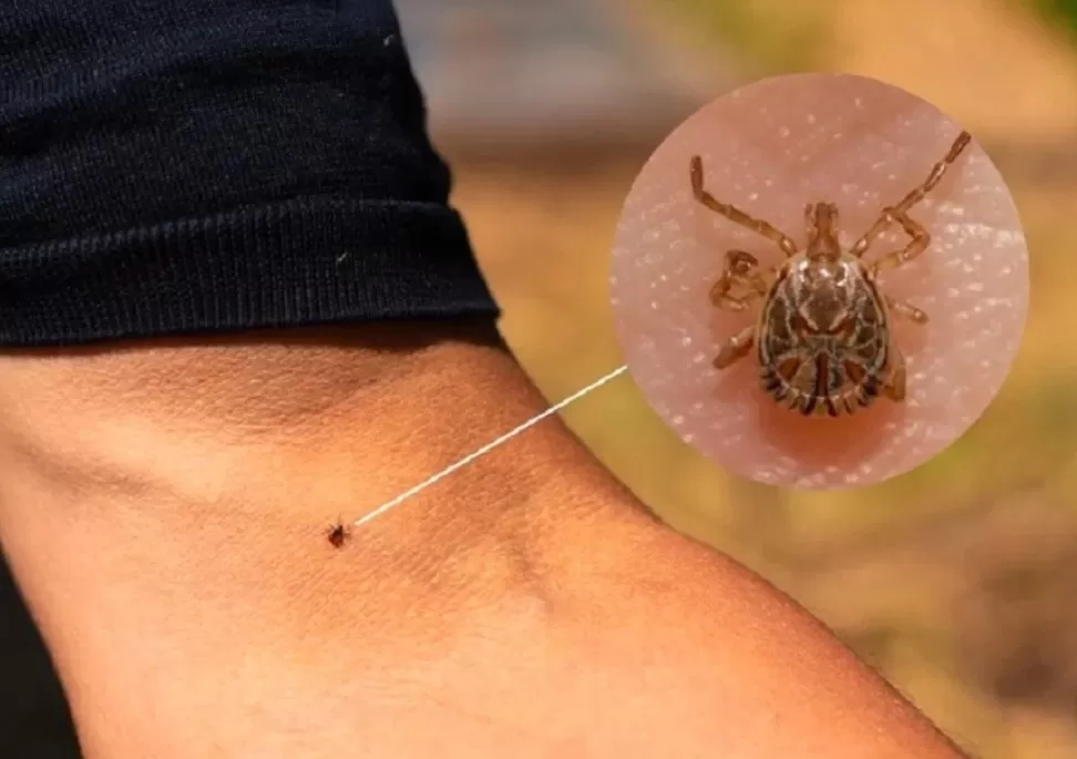 Febre Maculosa provoca duas mortes em Caeté e autoridades reforçam alerta à população